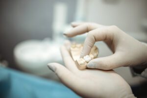 Dental Crowns in San Antonio, Texas